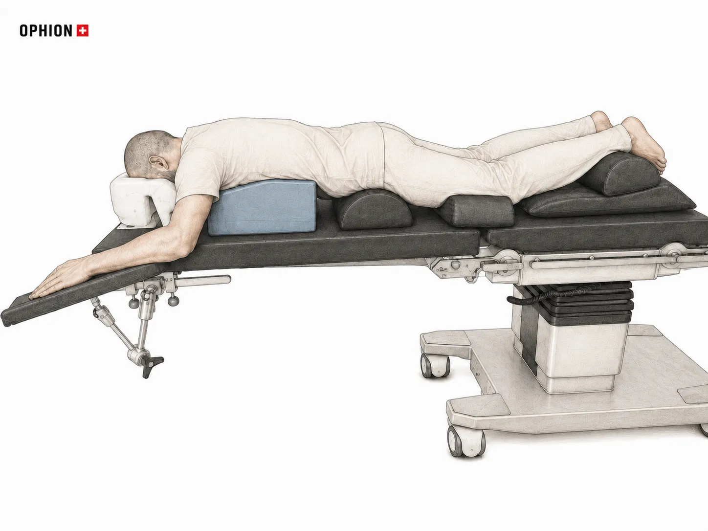 Bauchlage im OP – Prone Position auf einem Operationstisch mit OPHION Patientenlagerung