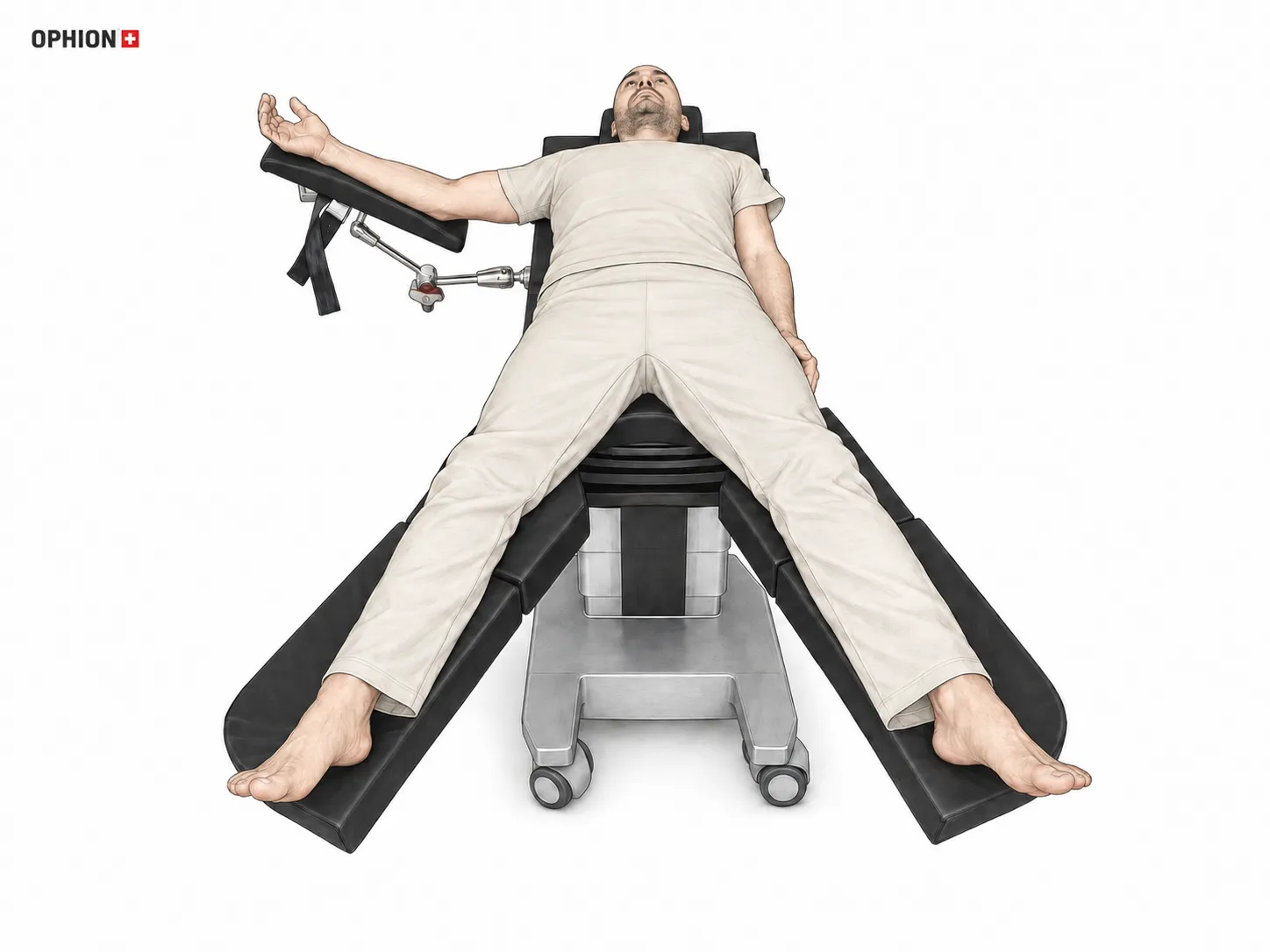 French-Position im OP mit getrennten gestreckten Beinen auf separaten Beinplatten – Split-Leg Position und OPHION Patientenlagerung