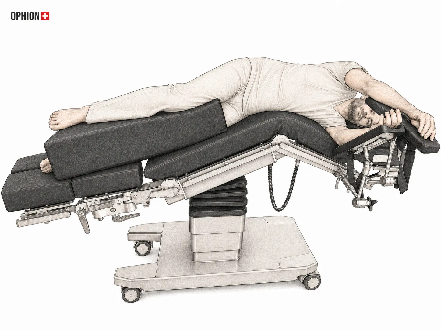 Seitenlage im OP – Lateral Position auf dem Operationstisch mit OPHION Patientenlagerung