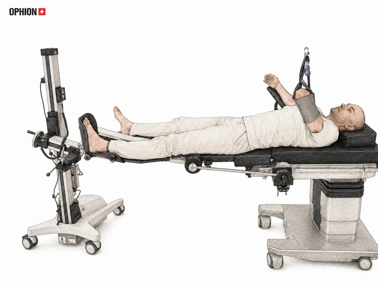 Extensionslagerung im OP auf einem Extensionstisch mit Traktionssystem